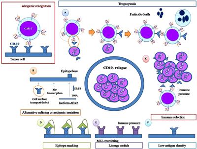 Failure of ALL recognition by CAR T cells: a review of CD 19-negative relapses after anti-CD 19 CAR-T treatment in B-ALL